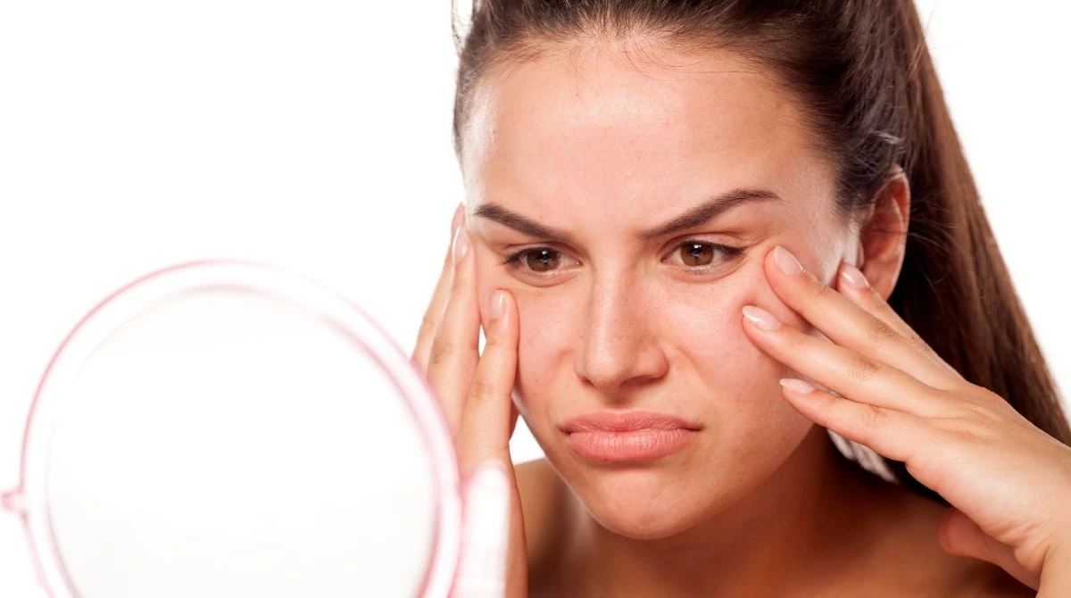 Жирна шкіра обличчя: основні правила догляду