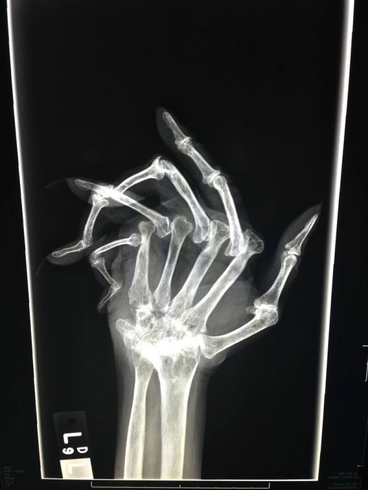 20 geavanceerde röntgenfoto's die niet alleen iemands botten vertoonden 7394_12