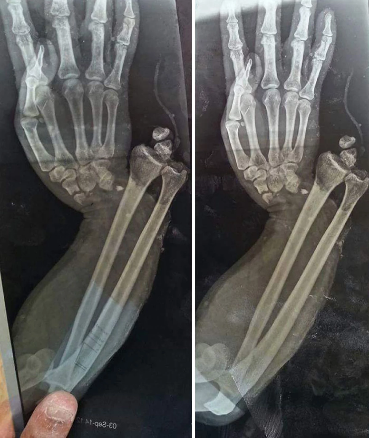 20 Napredne rentgenske posnetke, ki so pokazale ne samo kosti nekoga 7394_18