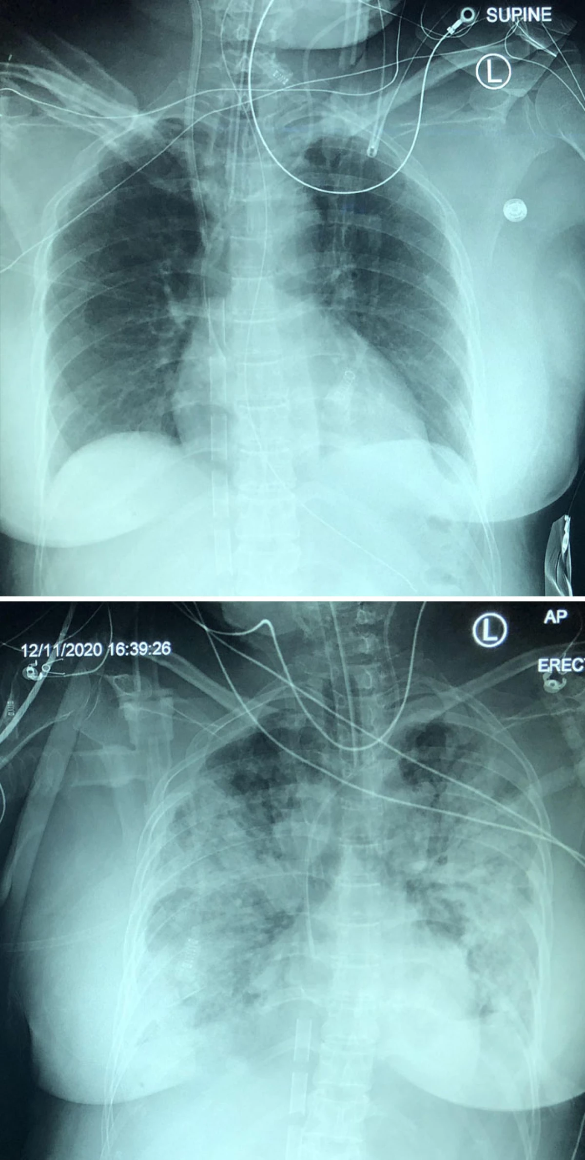 20 Napredne rentgenske posnetke, ki so pokazale ne samo kosti nekoga 7394_2