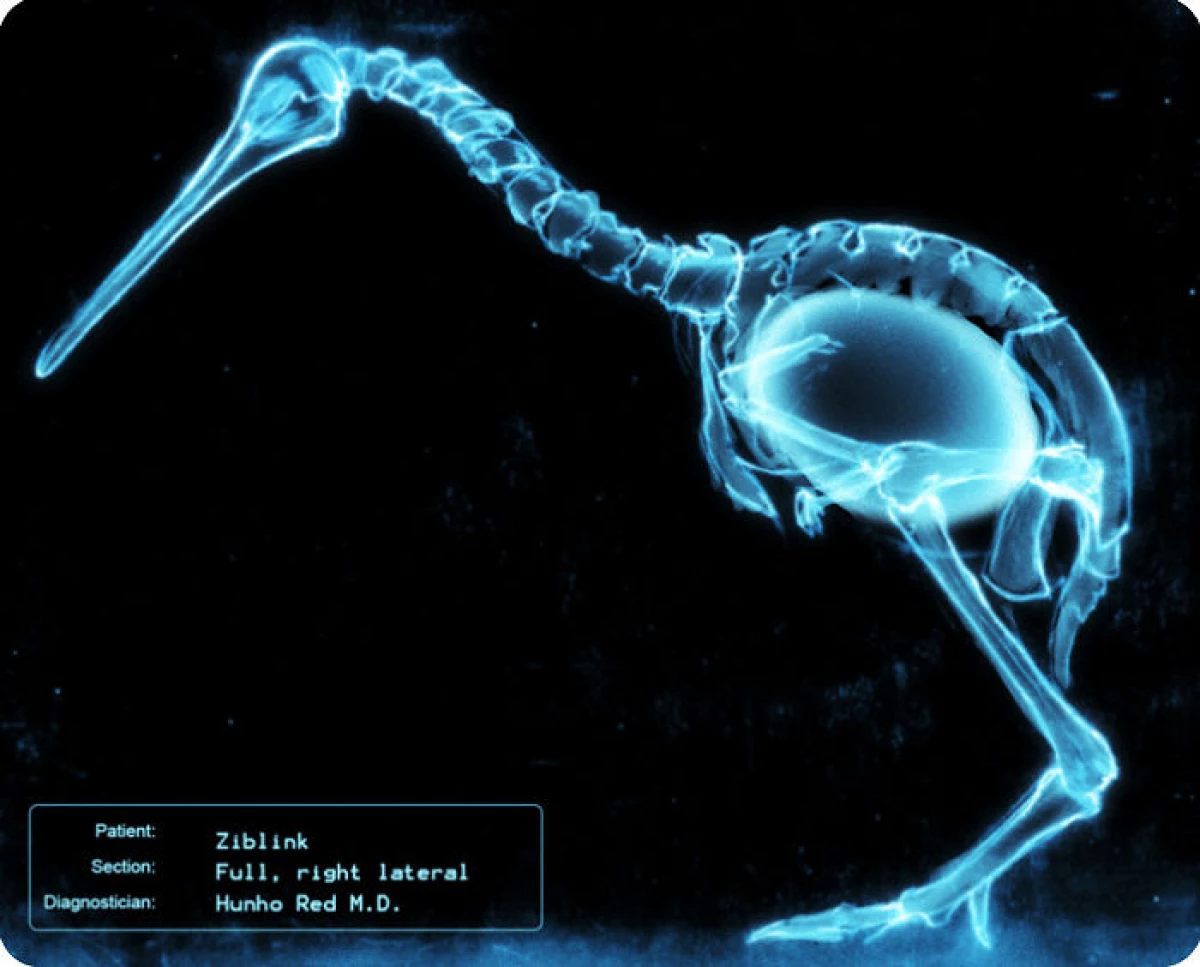 20 geavanceerde röntgenfoto's die niet alleen iemands botten vertoonden 7394_4