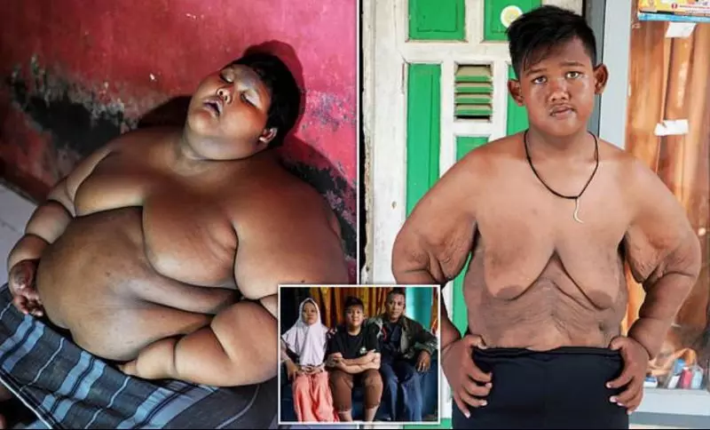 Den mest tykkelse i barnets verden formåede at tabe 108 kg: hvordan han blev nu