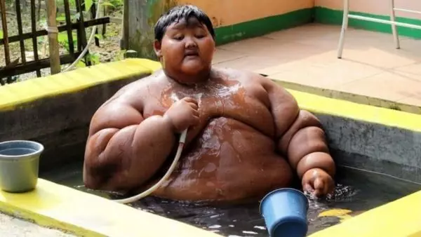 子供の世界で最も厚さは108 kgを失うことができた：彼が今どのようになったか 11243_1