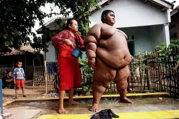 Бала дөньясындагы иң калынлык 108 кг югалта алды: ул ничек булды 11243_2