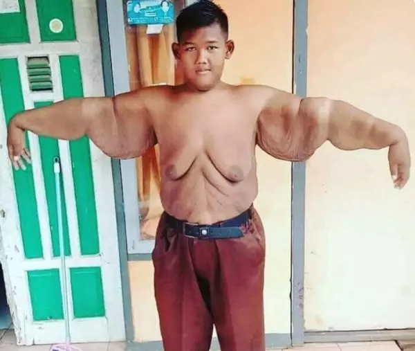 子供の世界で最も厚さは108 kgを失うことができた：彼が今どのようになったか 11243_5