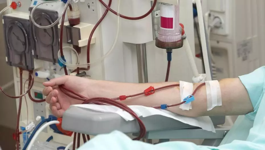 El sistema AI puede ayudar a prevenir la anemia en pacientes que se someten a un procedimiento de hemodiálisis.