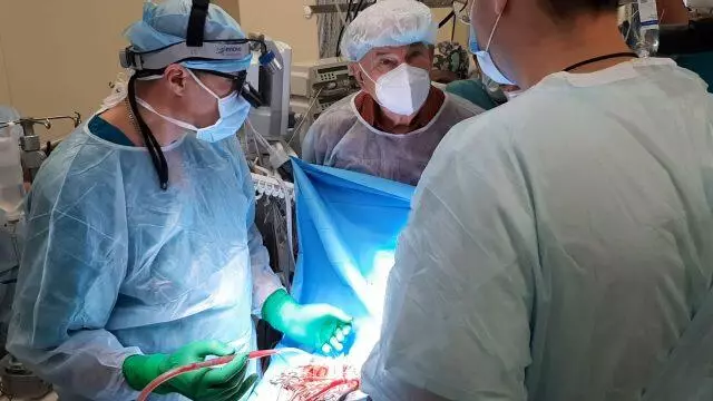 Els metges russos primer al món van portar a la perfusió de preparacions de quimioteràpia per al tractament del tumor cerebral al primat 12634_1
