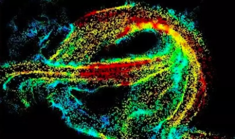 Die vaskulêre netwerk van die menslike brein is eers in 'n mikroskopiese skaal getoon