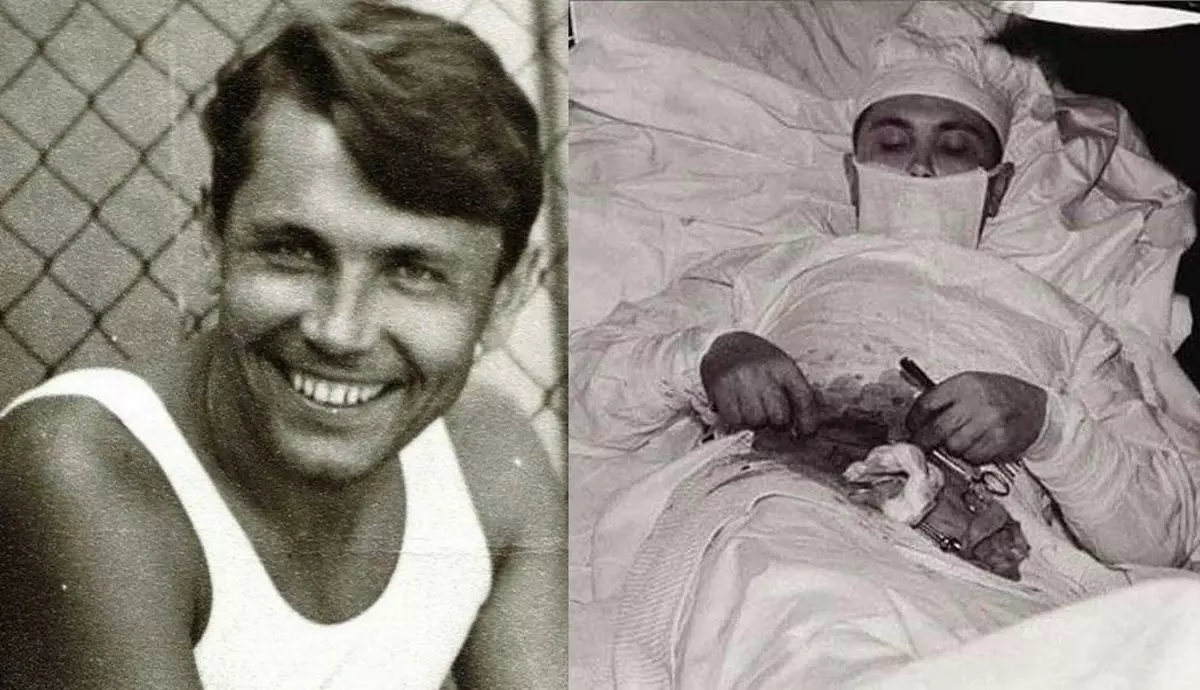 Leonid Rogozov. Povijest sovjetskog kirurga, koji je djelovao na sebe 21612_1