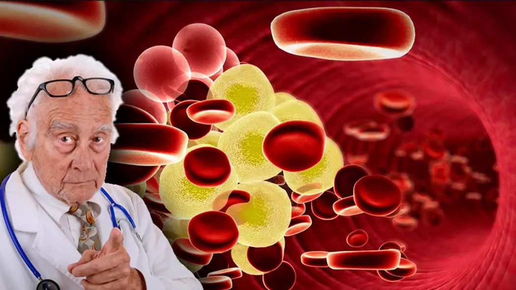Ärzte nannten zwei hochrangige Cholesterin-Symptome 2935_1